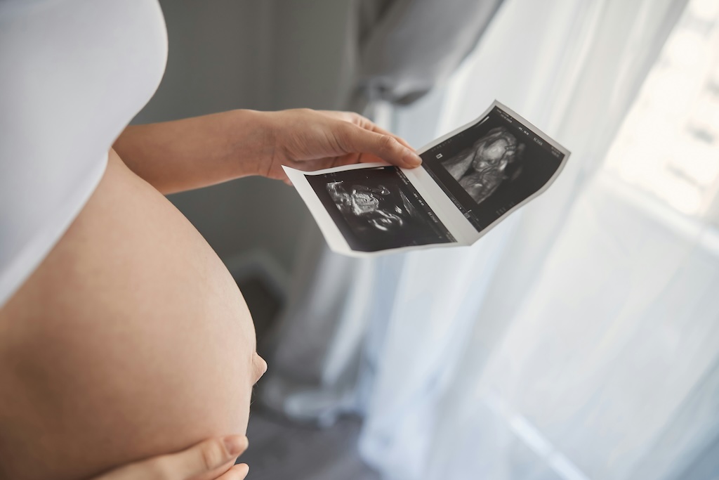 A woman with a visible pregnancy bump holding an ultrasound scan